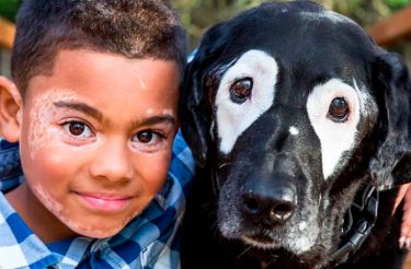 Cão ajuda menino a aceitar o próprio rosto