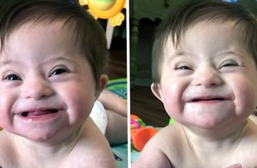 Bebê de 8 meses com síndrome de Down deu à mãe adotiva seu ‘novo sorriso’:”Ela está feliz”